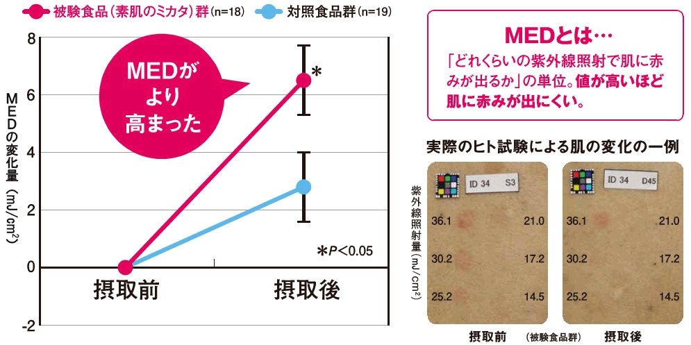 MEDとは・・・「どれくらいの紫外線照射で肌に赤みが出るか」の単位。値が高いほど肌に赤みが出にくい・グラフ：被験食品摂取後、MEDがより高まったことを示す・写真：実際のヒト試験による、被験食品摂取接種前後の肌の変化の一例の写真