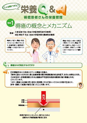 褥瘡患者さんの栄養管理 その1 褥瘡の概念とメカニズム