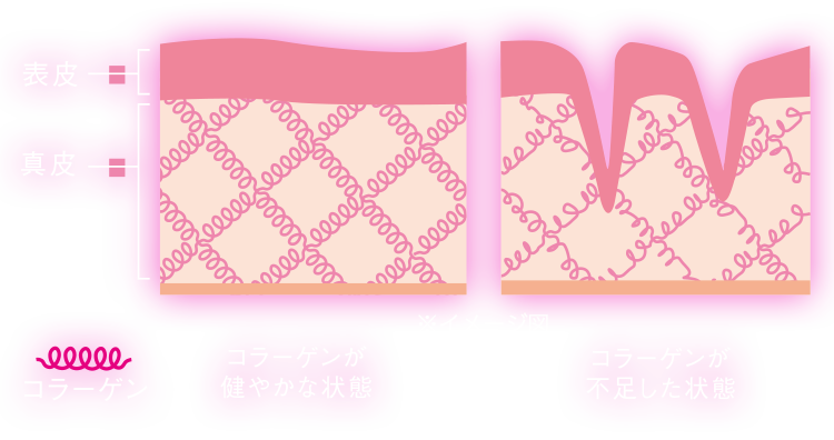 表皮 真皮 コラーゲンが健やかな状態 コラーゲンが不足した状態